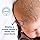 Mustela Cradle Cap Cream 40ml